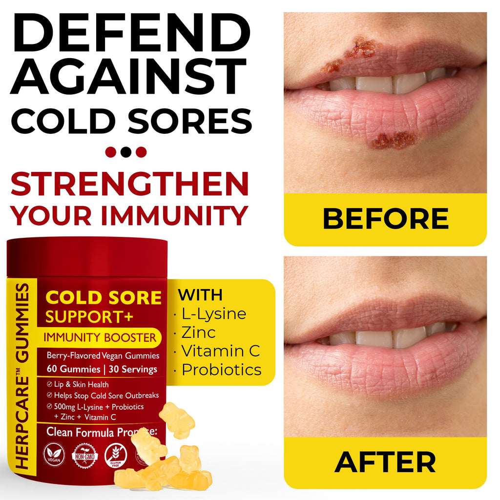 Cold Sore Treatment with L-Lysine, Zinc & Vitamin C U25821