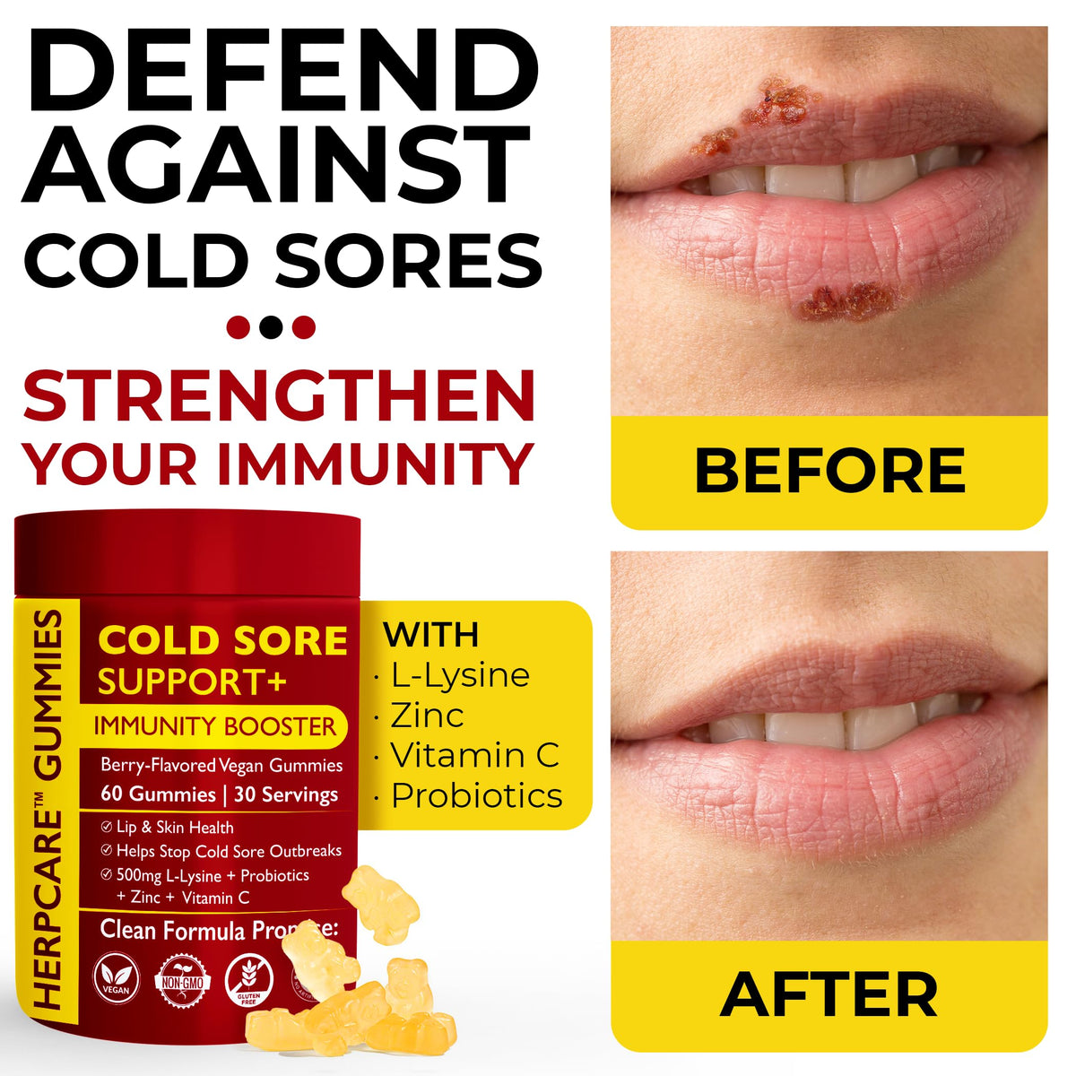 Cold Sore Treatment with L-Lysine, Zinc & Vitamin C U25821